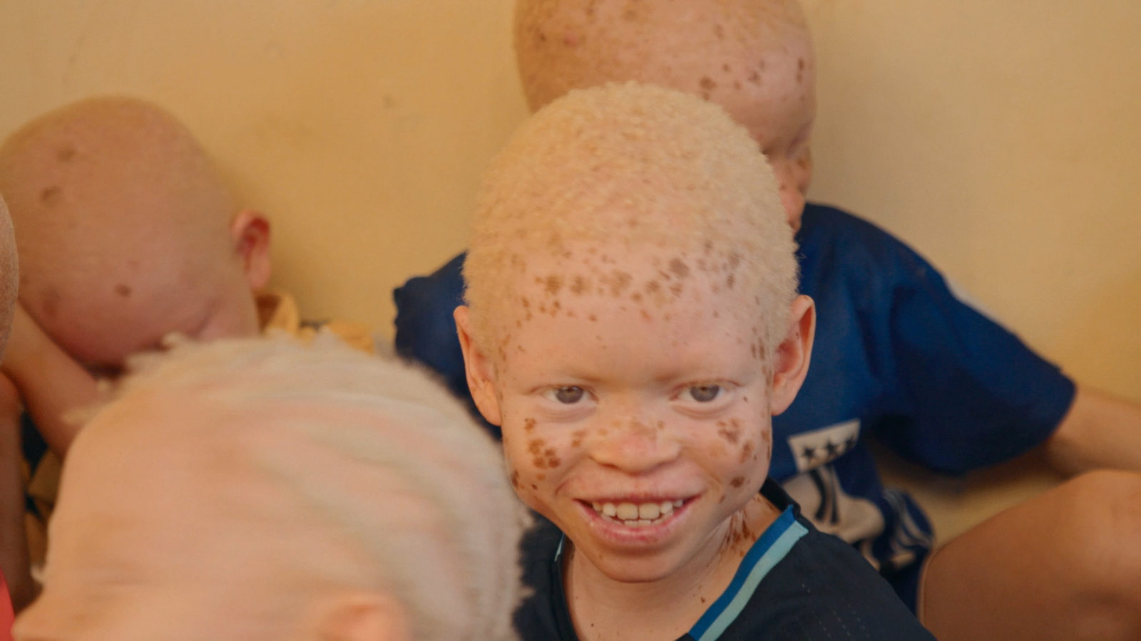 Документальный фильм «Ангелы Милы» о спасении альбиносов Африки выйдет в кинотеатрах по всей России